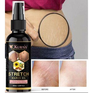 Kuraiy stretch Oil for Stretch Marks Removal Post Pregnancy fast work result stretch mark cream oil (50 ml)